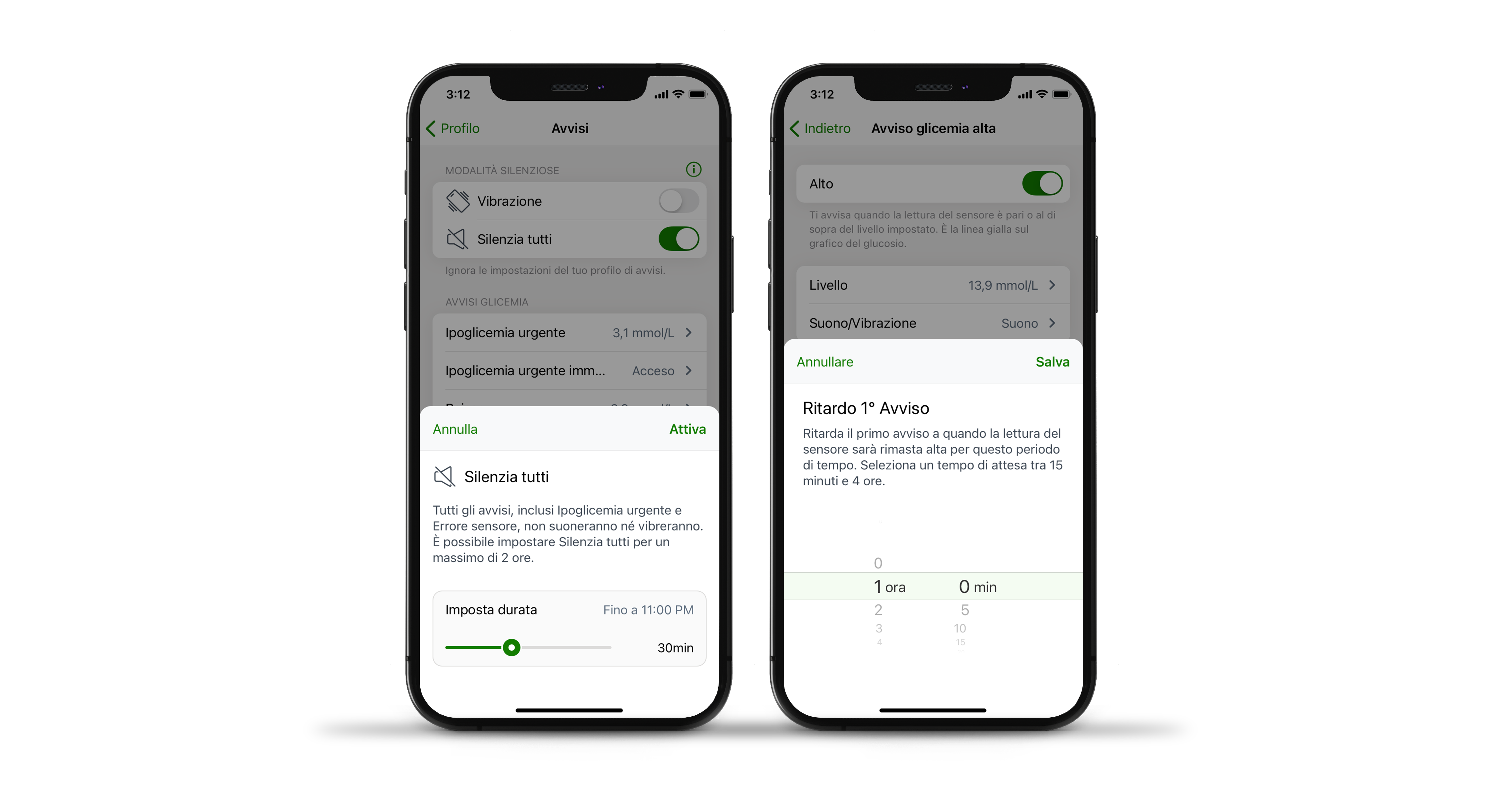 Avvisi di glucosio alto e impostazioni degli avvisi nell'applicazione Dexcom G7